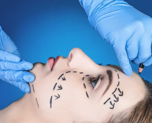 جراحی زیبایی صورت