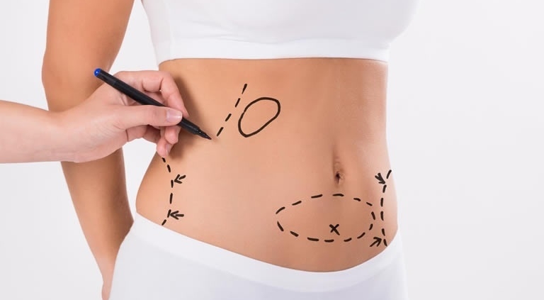 پیکرتراشی بدن