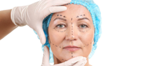 هزینه لیفت صورت در کرج