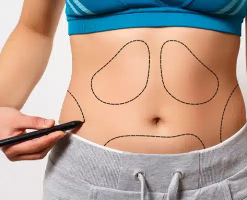 جراحی پیکرتراشی در تهران