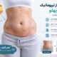 ورم بعد از لیپوماتیک شکم و پهلو